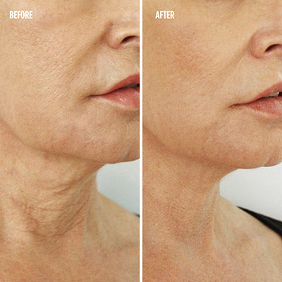 Beauty Revive Magic Wand