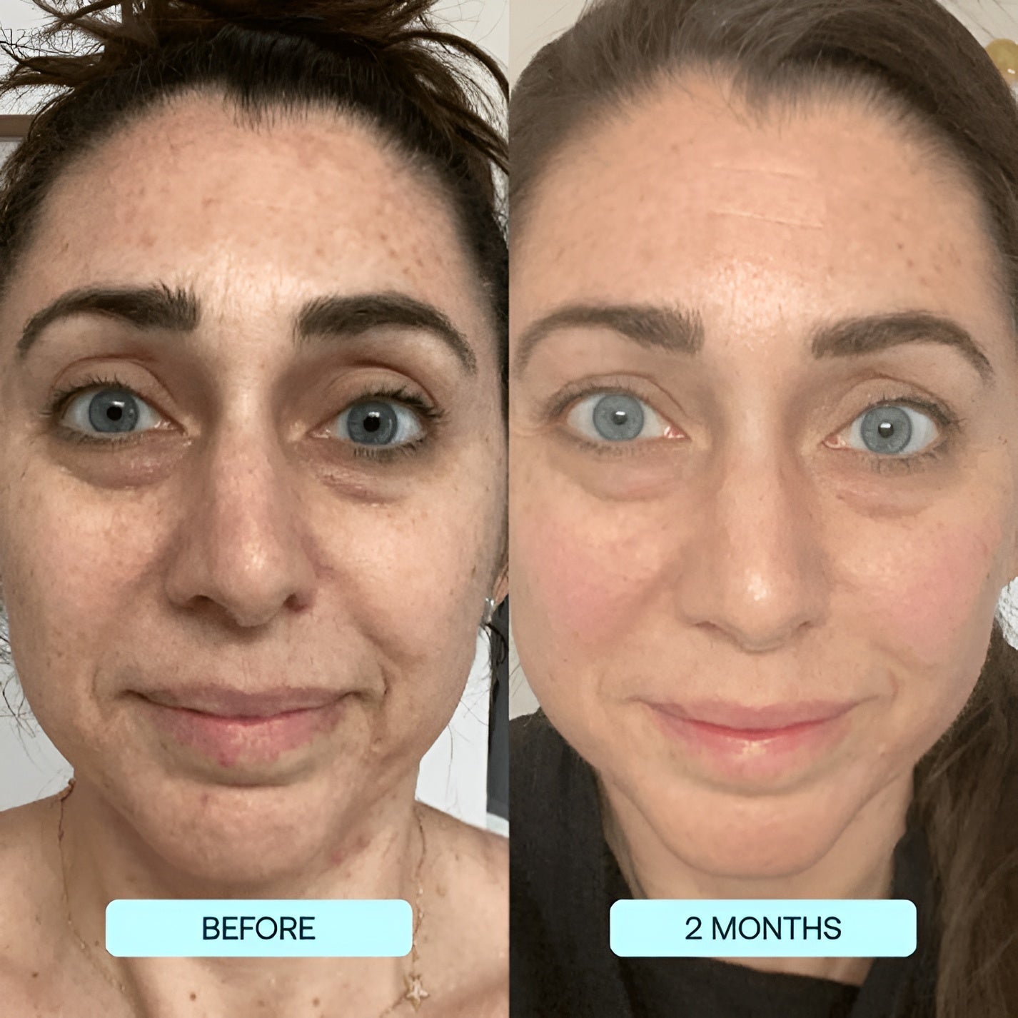 SkinRevive Collagen Sheets: Glow & Renew