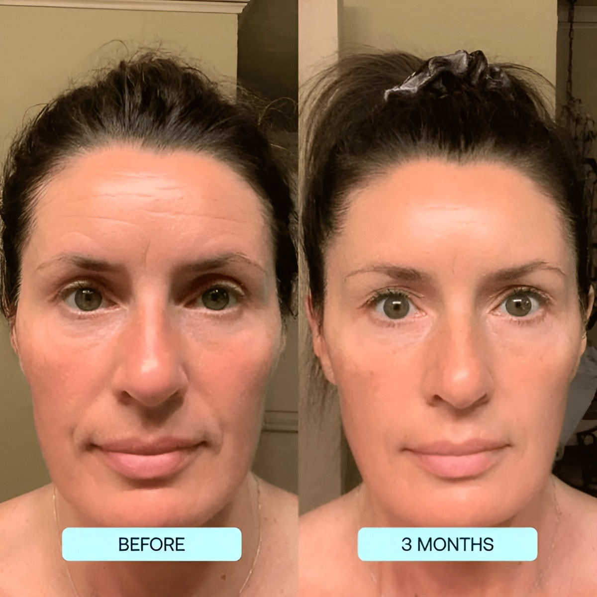 SkinRevive Collagen Sheets: Glow & Renew