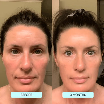 SkinRevive Collagen Sheets: Glow & Renew
