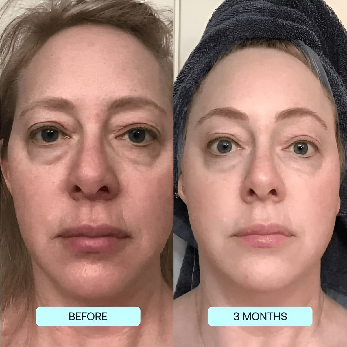 SkinRevive Collagen Sheets: Glow & Renew