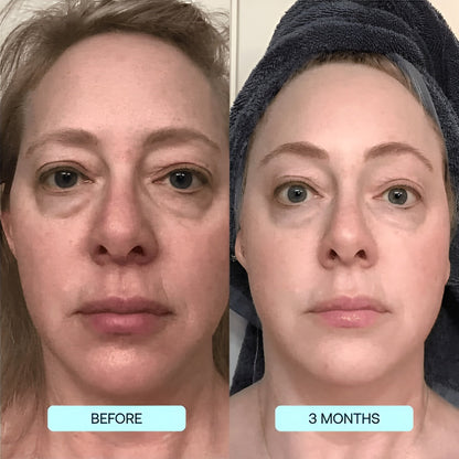 SkinRevive Collagen Sheets: Glow & Renew