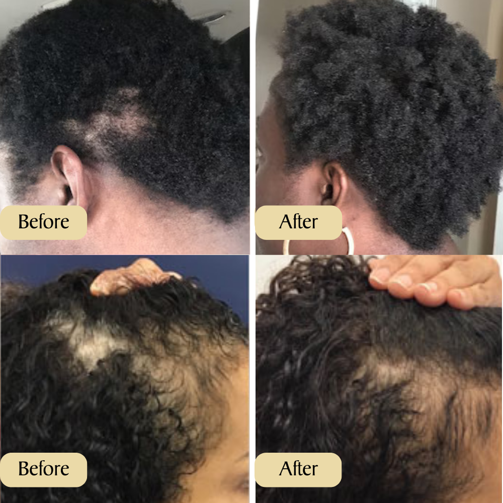 Veganic Growth Elixir
